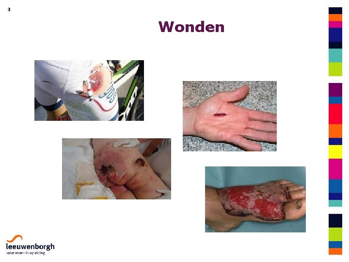 3 Wonden 