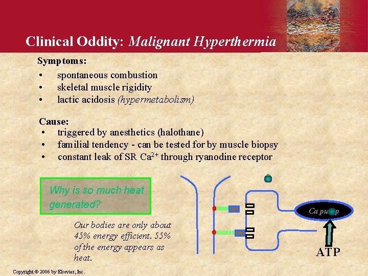 Clinical Oddity: Malignant Hyperthermia Symptoms: • spontaneous combustion • skeletal muscle rigidity • lactic
