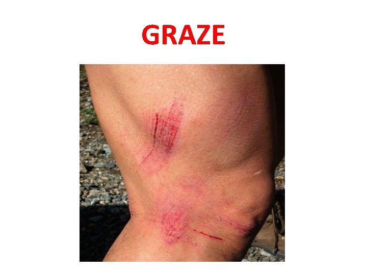 GRAZE 