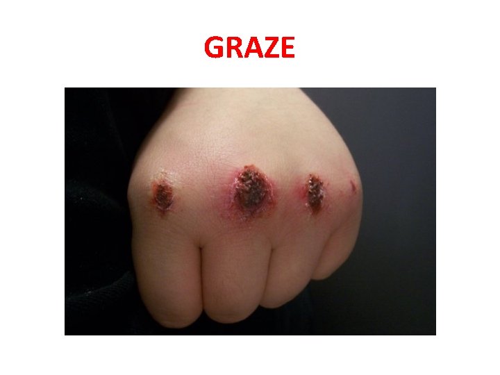 GRAZE 