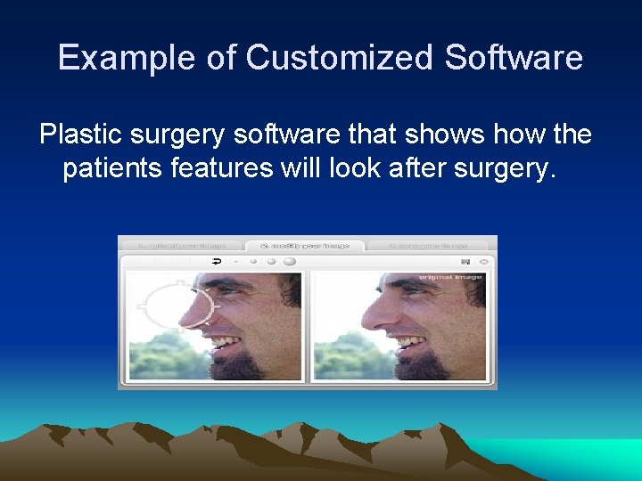 Example of Customized Software Plastic surgery software that shows how the patients features will