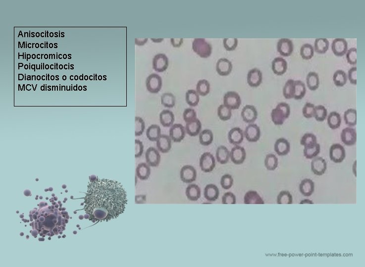 Anisocitosis Microcitos Hipocromicos Poiquilocitocis Dianocitos o codocitos MCV disminuidos 