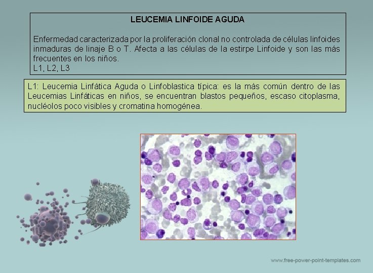 LEUCEMIA LINFOIDE AGUDA Enfermedad caracterizada por la proliferación clonal no controlada de células linfoides