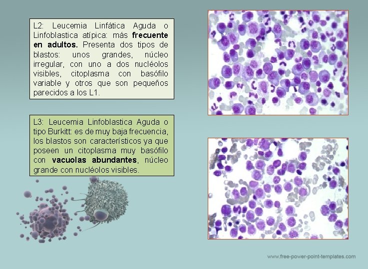 L 2: Leucemia Linfática Aguda o Linfoblastica atípica: más frecuente en adultos. Presenta dos
