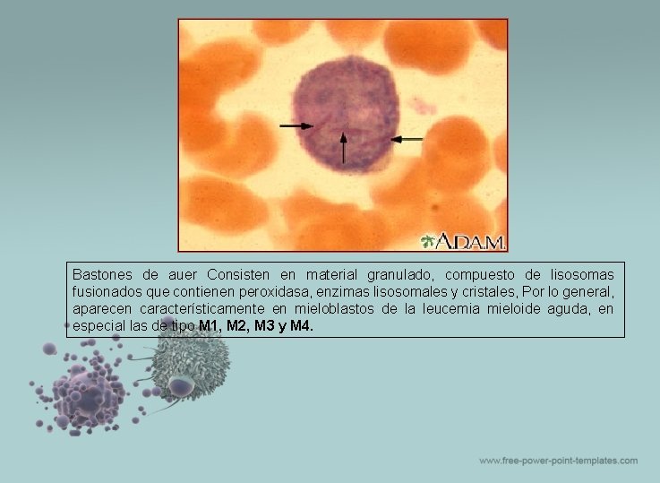 Bastones de auer Consisten en material granulado, compuesto de lisosomas fusionados que contienen peroxidasa,