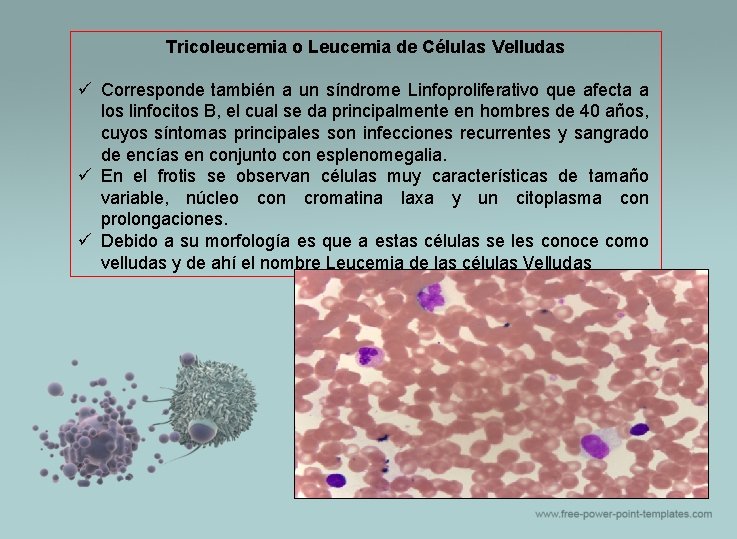 Tricoleucemia o Leucemia de Células Velludas ü Corresponde también a un síndrome Linfoproliferativo que