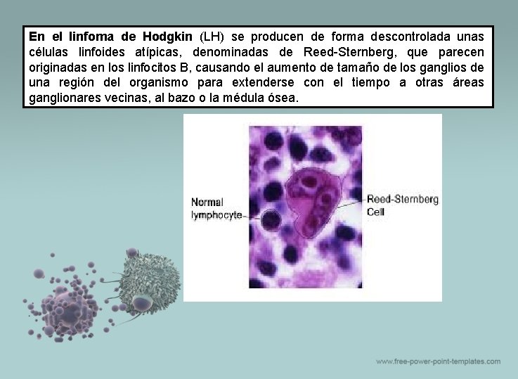 En el linfoma de Hodgkin (LH) se producen de forma descontrolada unas células linfoides