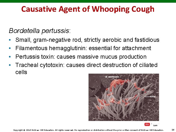 Causative Agent of Whooping Cough Bordetella pertussis: • • Small, gram-negative rod, strictly aerobic
