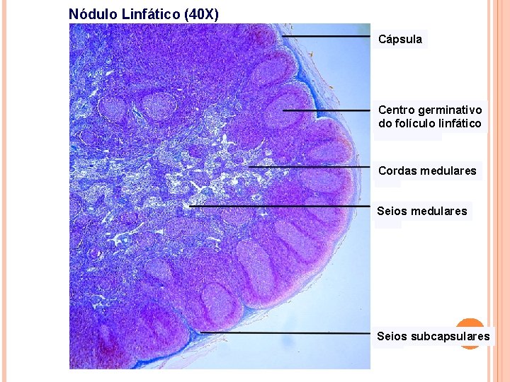 Nódulo Linfático (40 X) Cápsula Centro germinativo do folículo linfático Cordas medulares Seios subcapsulares