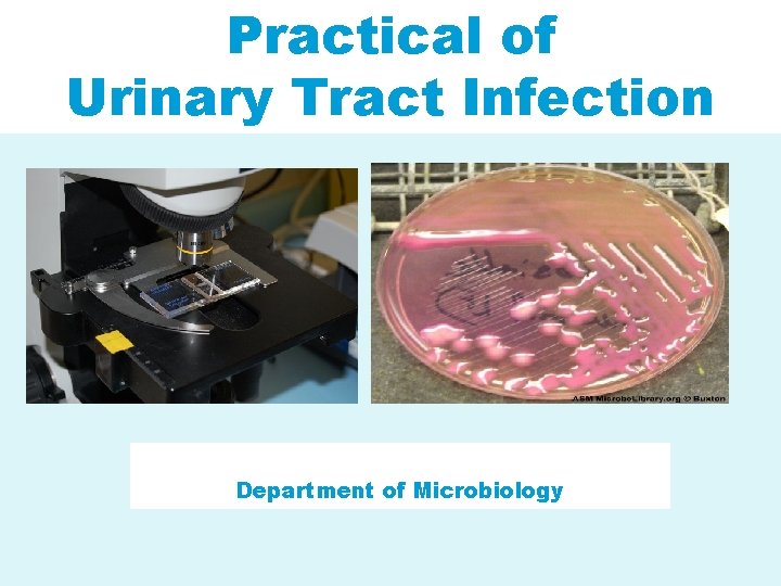Practical of Urinary Tract Infection Department of Microbiology 