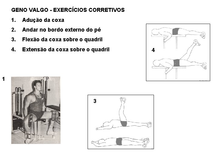 GENO VALGO - EXERCÍCIOS CORRETIVOS 1. Adução da coxa 2. Andar no bordo externo