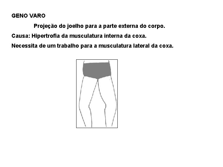 GENO VARO Projeção do joelho para a parte externa do corpo. Causa: Hipertrofia da