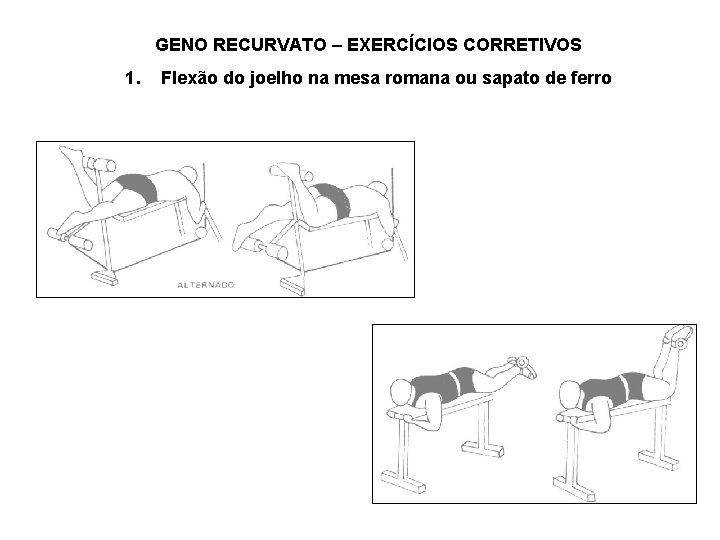 GENO RECURVATO – EXERCÍCIOS CORRETIVOS 1. Flexão do joelho na mesa romana ou sapato