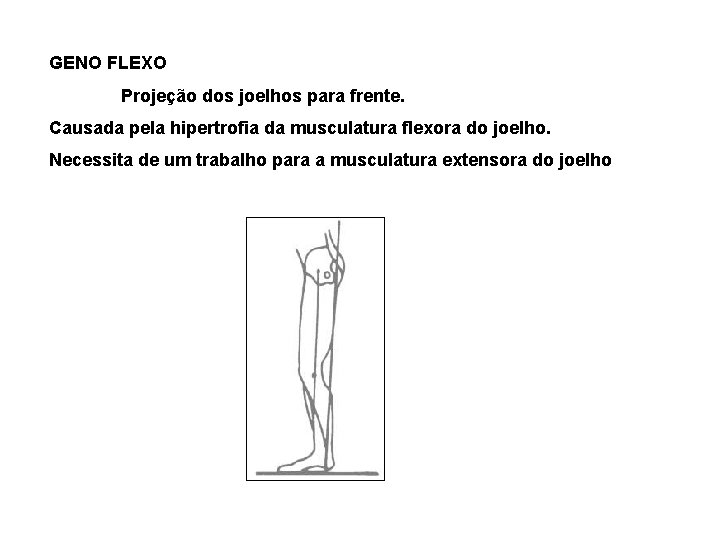 GENO FLEXO Projeção dos joelhos para frente. Causada pela hipertrofia da musculatura flexora do