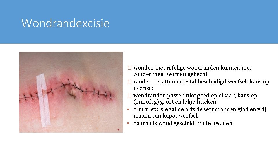 Wondrandexcisie � wonden met rafelige wondranden kunnen niet zonder meer worden gehecht. � randen