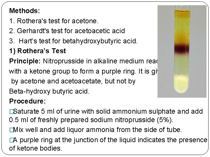 Methods: 1. Rothera's test for acetone. 2. Gerhardt's test for acetoacetic acid 3. Hart’s