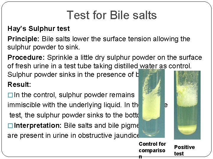 Test for Bile salts Hay’s Sulphur test Principle: Bile salts lower the surface tension