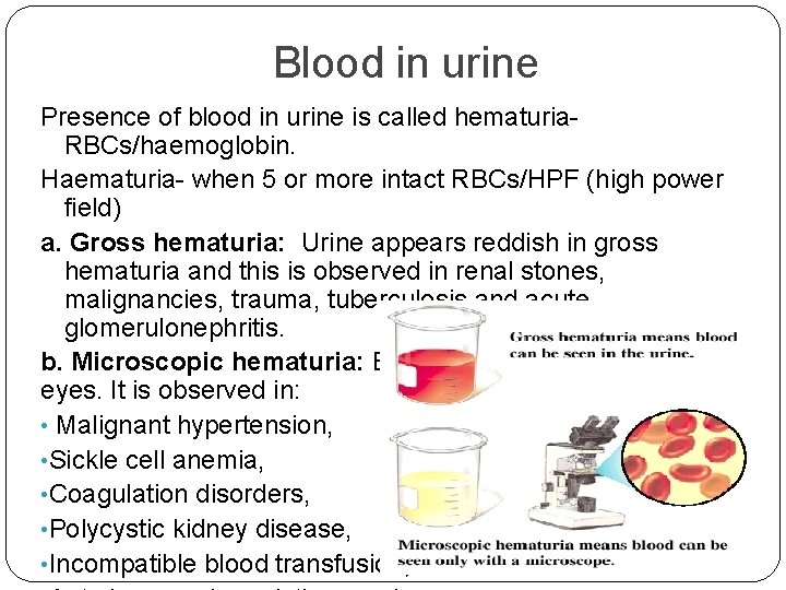 Blood in urine Presence of blood in urine is called hematuria. RBCs/haemoglobin. Haematuria- when