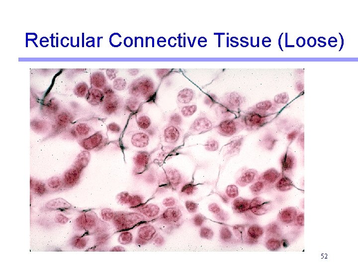 Reticular Connective Tissue (Loose) 52 