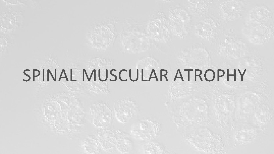 SPINAL MUSCULAR ATROPHY SPINAL MUSCULAR ATROPHY