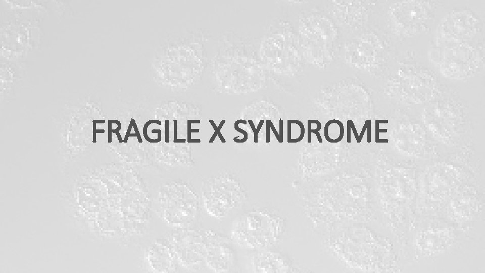 FRAGILE X SYNDROME FRAGILE X SYNDROME