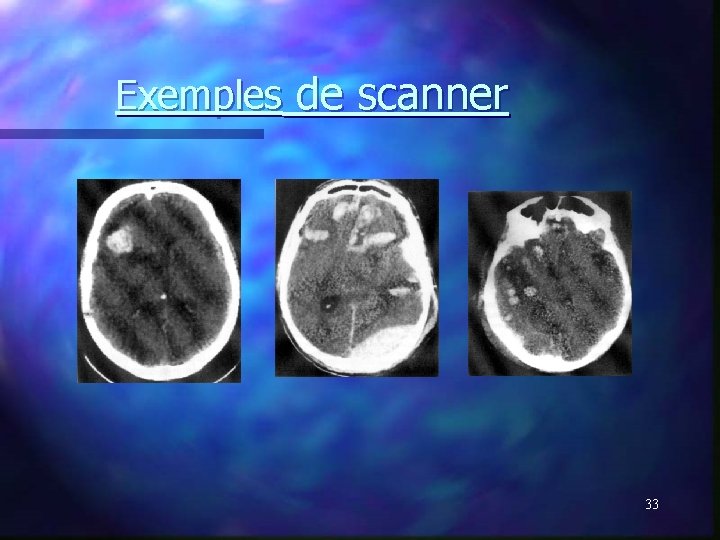 Exemples de scanner 33 Exemples de scanner 33
