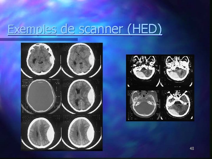 Exemples de scanner (HED) 48 Exemples de scanner (HED) 48