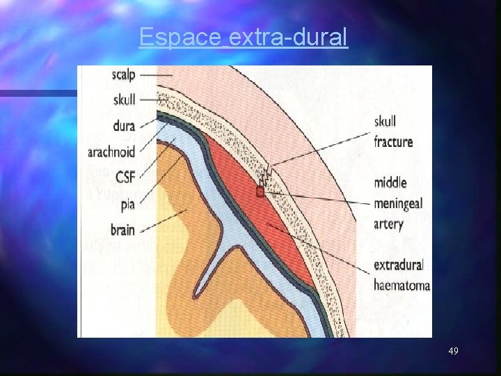 Espace extra-dural 49 Espace extra-dural 49