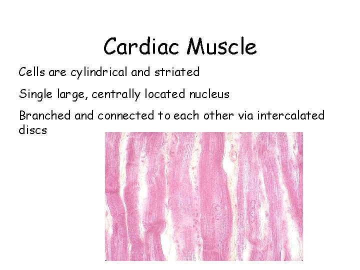 Cardiac Muscle Cells are cylindrical and striated Single large, centrally located nucleus Branched and