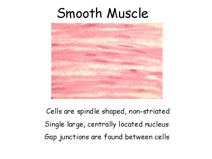 Smooth Muscle Cells are spindle shaped, non-striated Single large, centrally located nucleus Gap junctions