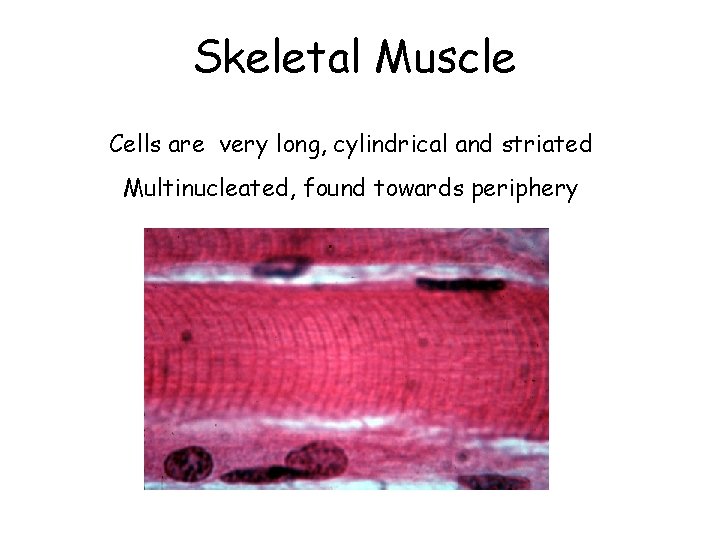 Skeletal Muscle Cells are very long, cylindrical and striated Multinucleated, found towards periphery 