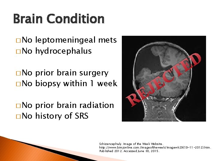 Brain Condition � No leptomeningeal mets � No hydrocephalus D E prior brain surgery