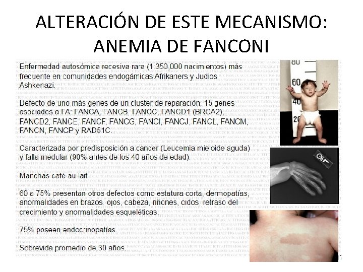 ALTERACIÓN DE ESTE MECANISMO: ANEMIA DE FANCONI 