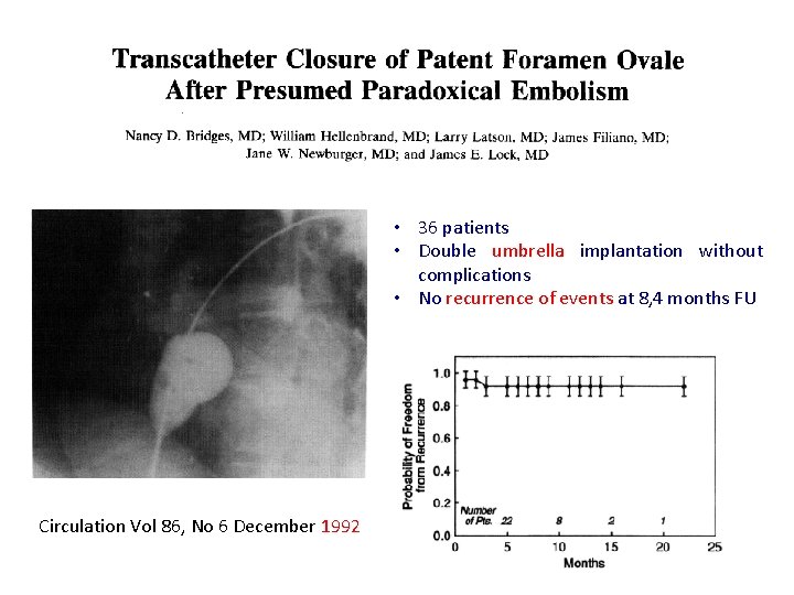 • 36 patients • Double umbrella implantation without complications • No recurrence of • 36 patients • Double umbrella implantation without complications • No recurrence of