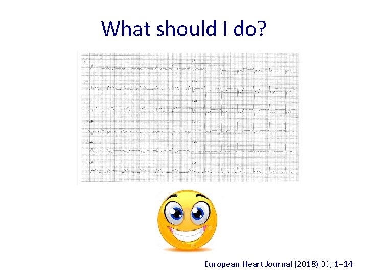 What should I do? European Heart Journal (2018) 00, 1– 14 What should I do? European Heart Journal (2018) 00, 1– 14
