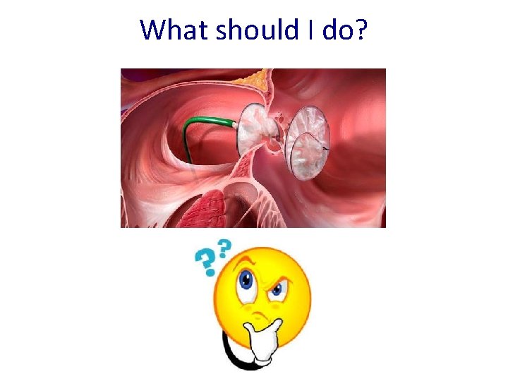 What should I do? What should I do?