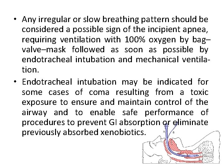  • Any irregular or slow breathing pattern should be considered a possible sign