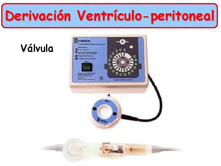 Derivación Ventrículo-peritoneal Válvula 
