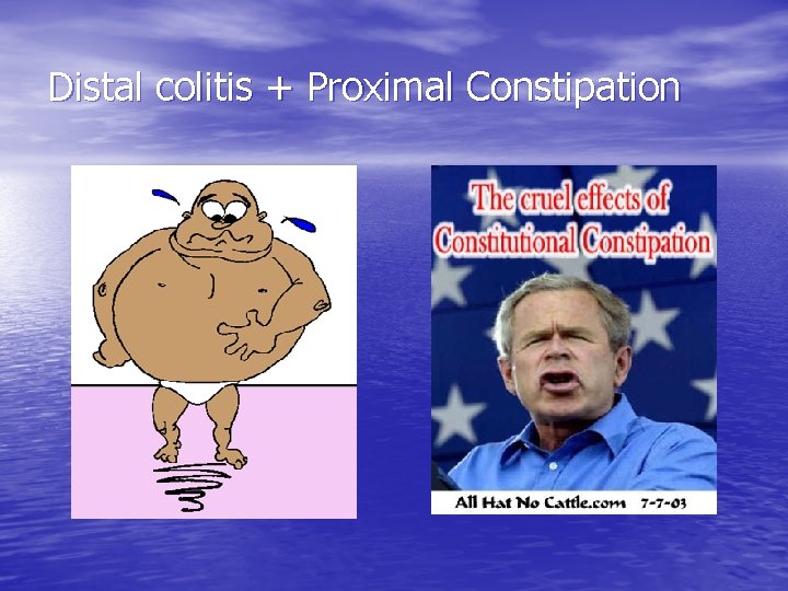 Distal colitis + Proximal Constipation 