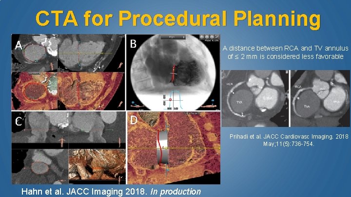 CTA for Procedural Planning A distance between RCA and TV annulus of ≤ 2