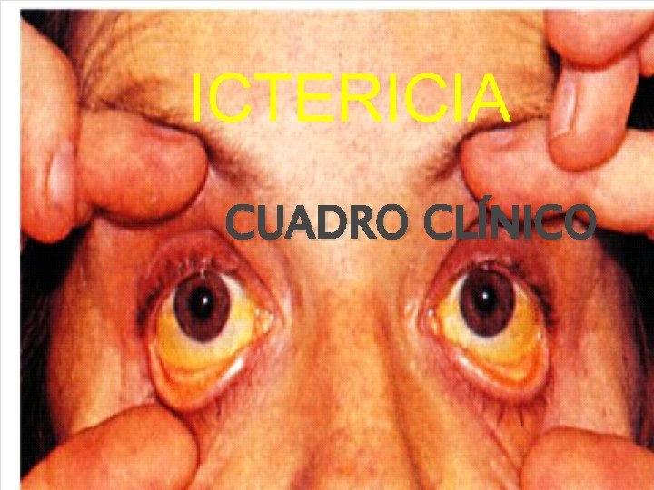 CUADRO CLÍNICO CUADRO CLÍNICO