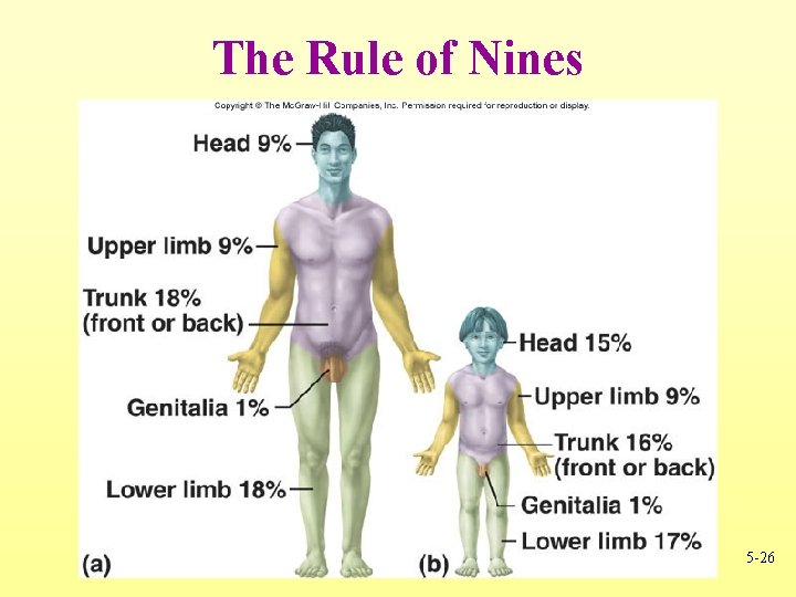 The Rule of Nines 5 -26 