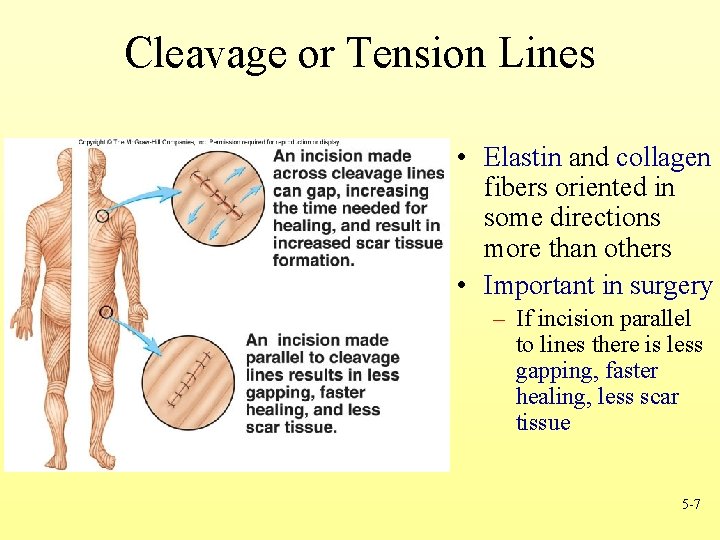 Cleavage or Tension Lines • Elastin and collagen fibers oriented in some directions more