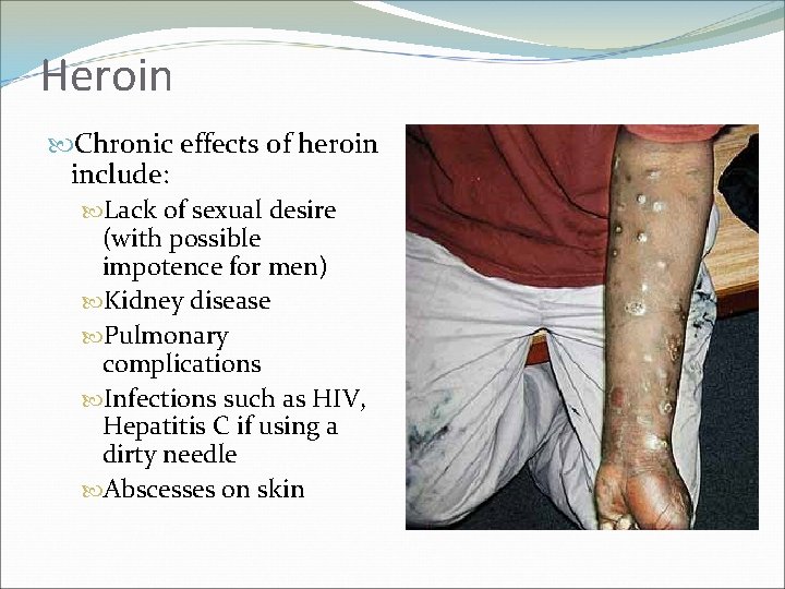 Heroin Chronic effects of heroin include: Lack of sexual desire (with possible impotence for