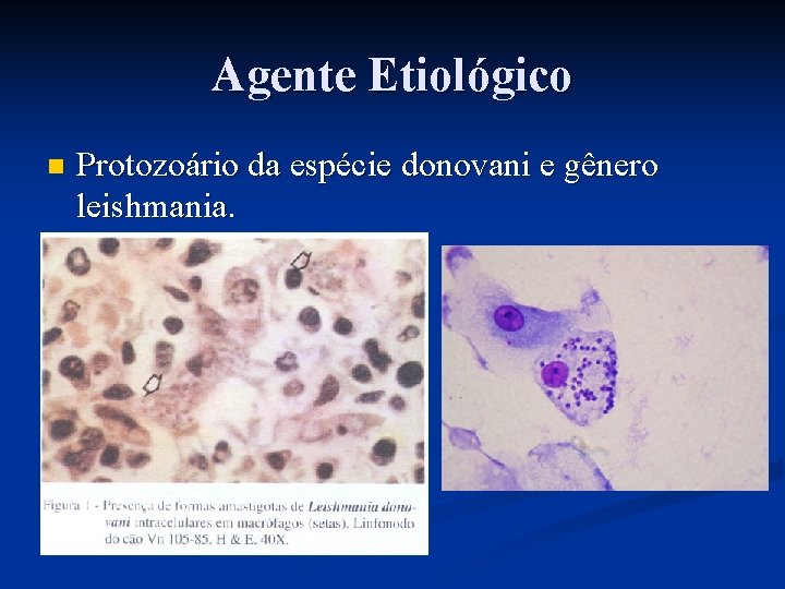 Agente Etiológico n Protozoário da espécie donovani e gênero leishmania. 