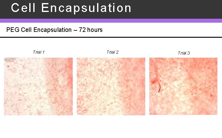 Cell Encapsulation PEG Cell Encapsulation – 72 hours Trial 1 Trial 2 Trial 3