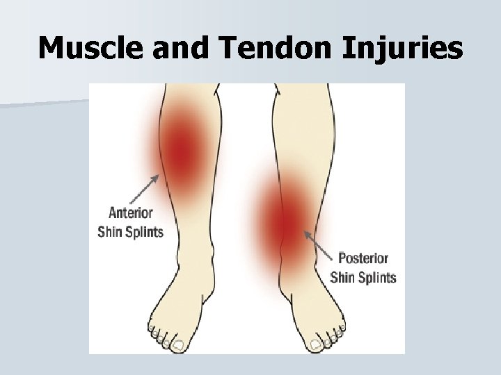 Muscle and Tendon Injuries 