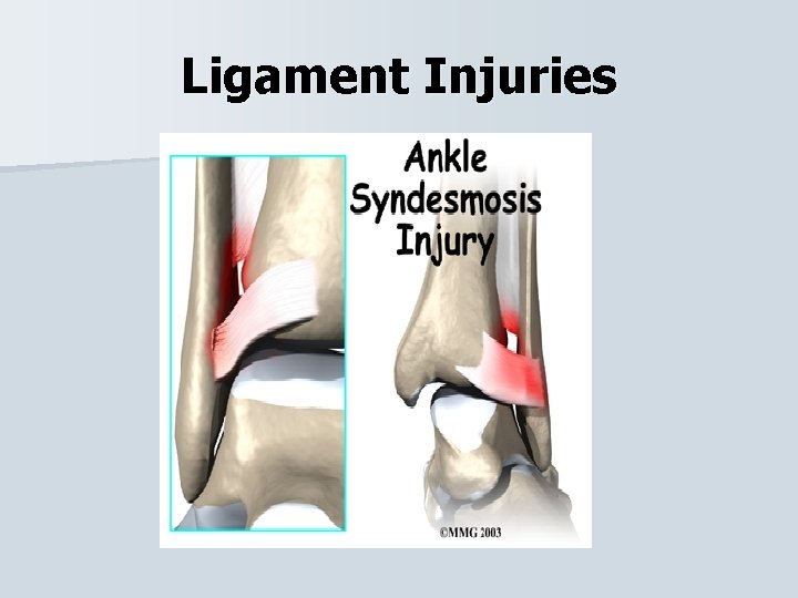 Ligament Injuries 