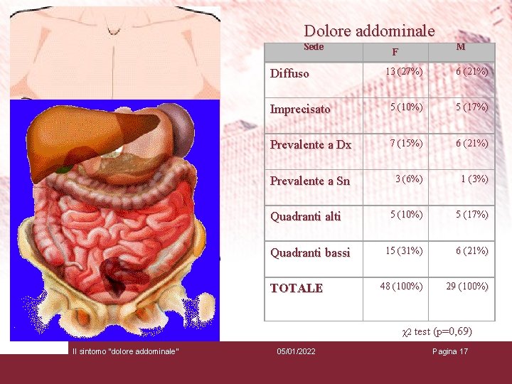 Dolore addominale Sede M F 13 (27%) 6 (21%) Imprecisato 5 (10%) 5 (17%)