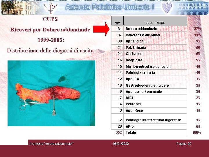 CUPS Ricoveri per Dolore addominale 1999 -2003: Distribuzione delle diagnosi di uscita num 131